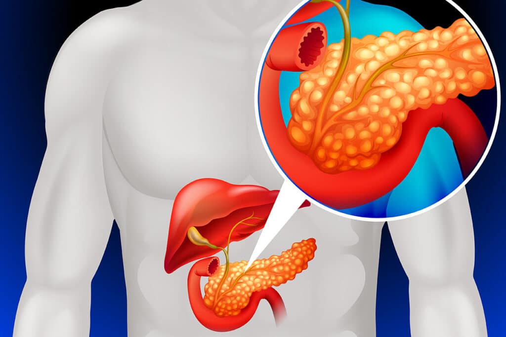 Coenzima Q10 e pancreatite