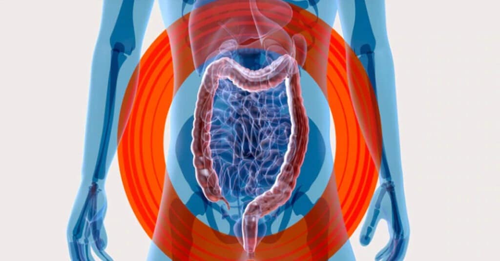 Microbiota intestinal e inflamação